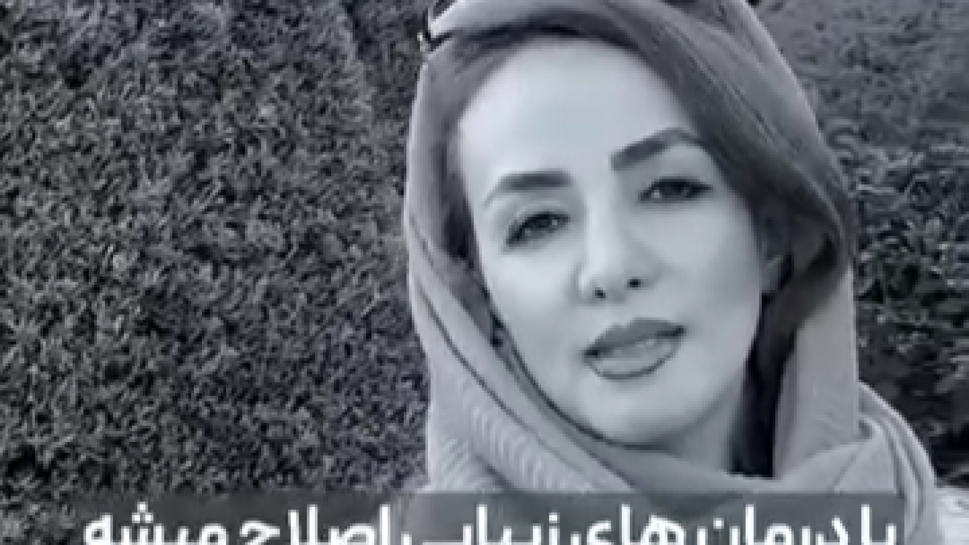درمان اصلاحی به هم ریختگی دندان دکتر ندا هادی-دندانپزشک زیبایی