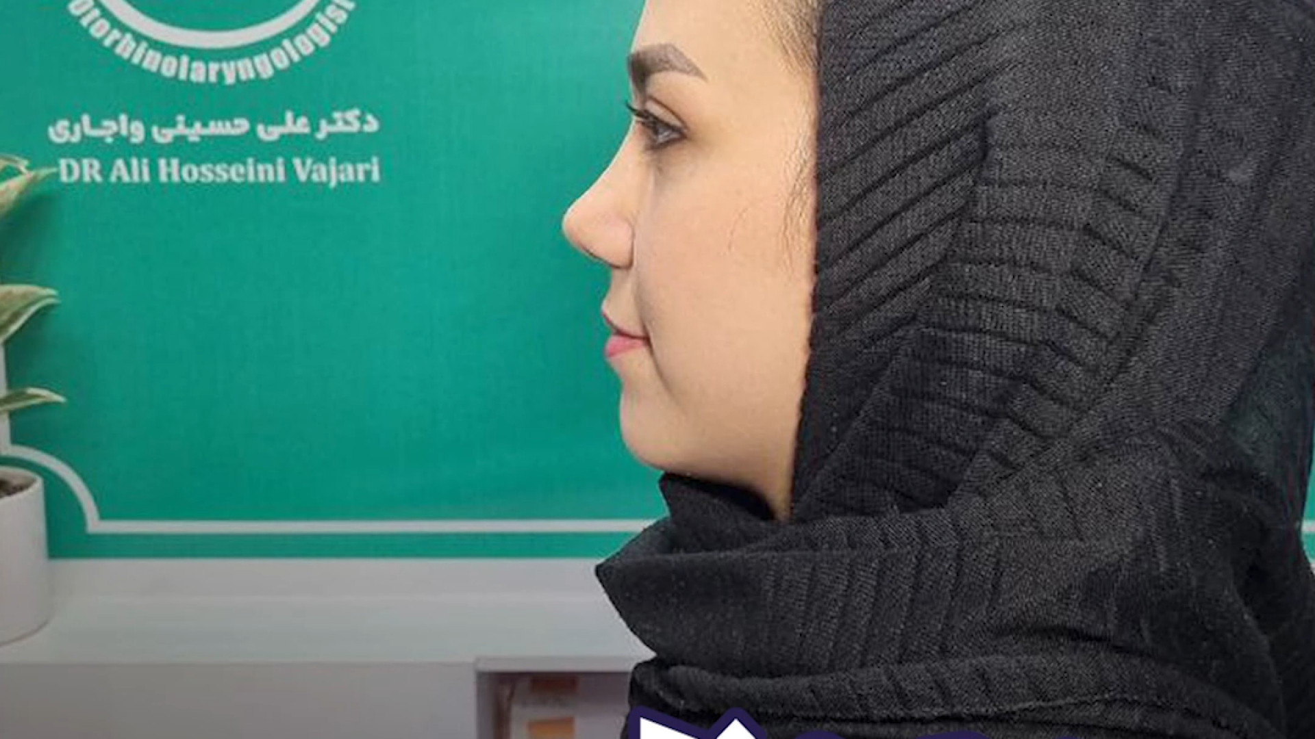 جراحی بینی طبیعی | دکتر علی حسینی واجاری دکتر علی حسینی واجاری - جراح بینی رشت