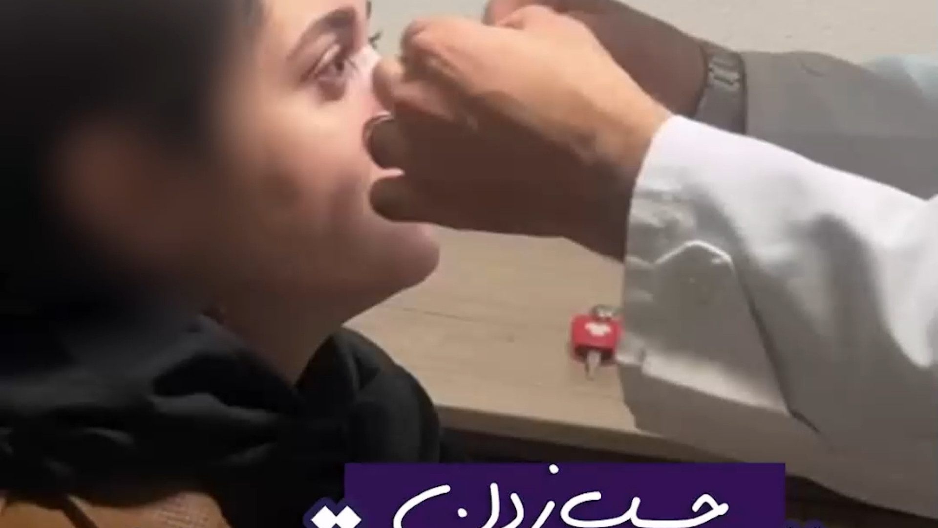چسب زدن بینی | دکتر علی حسینی واجاری دکتر علی حسینی واجاری - جراح بینی رشت