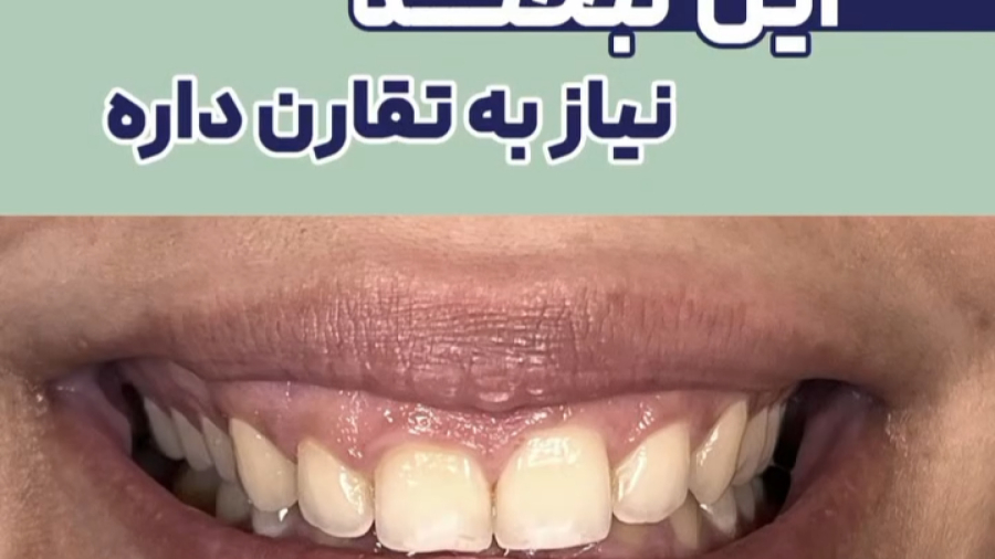 این لبخند نیاز به تقارن داره | دکتر ستاره هاشمی