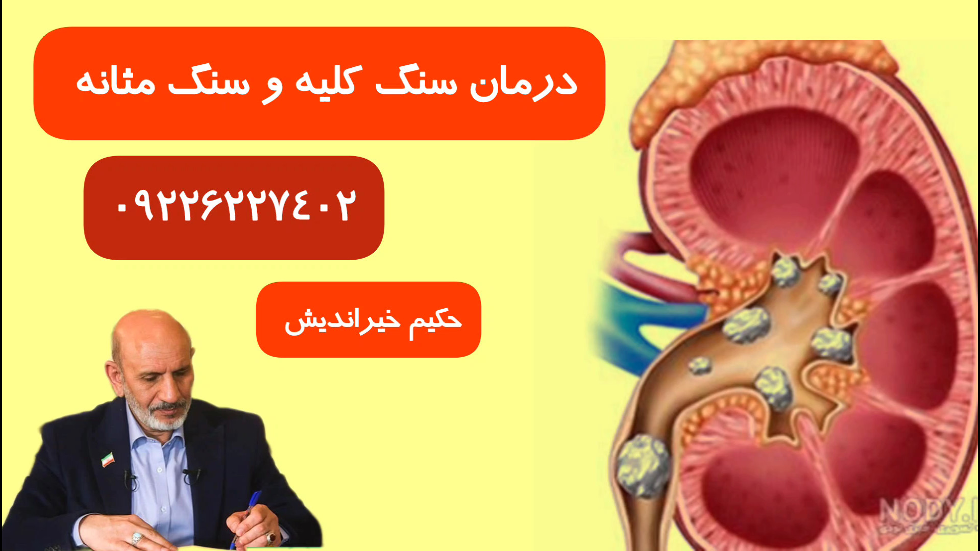 درمان سنگ کلیه پریودنتیکس