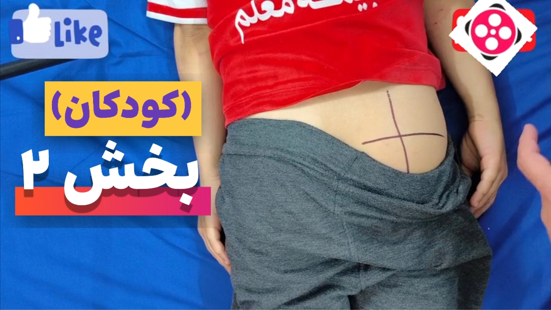 آموزش تزریق آمپول در کودکان و بزرگسالان (ترکیبی -آموزشی) تزریق بوتاکس