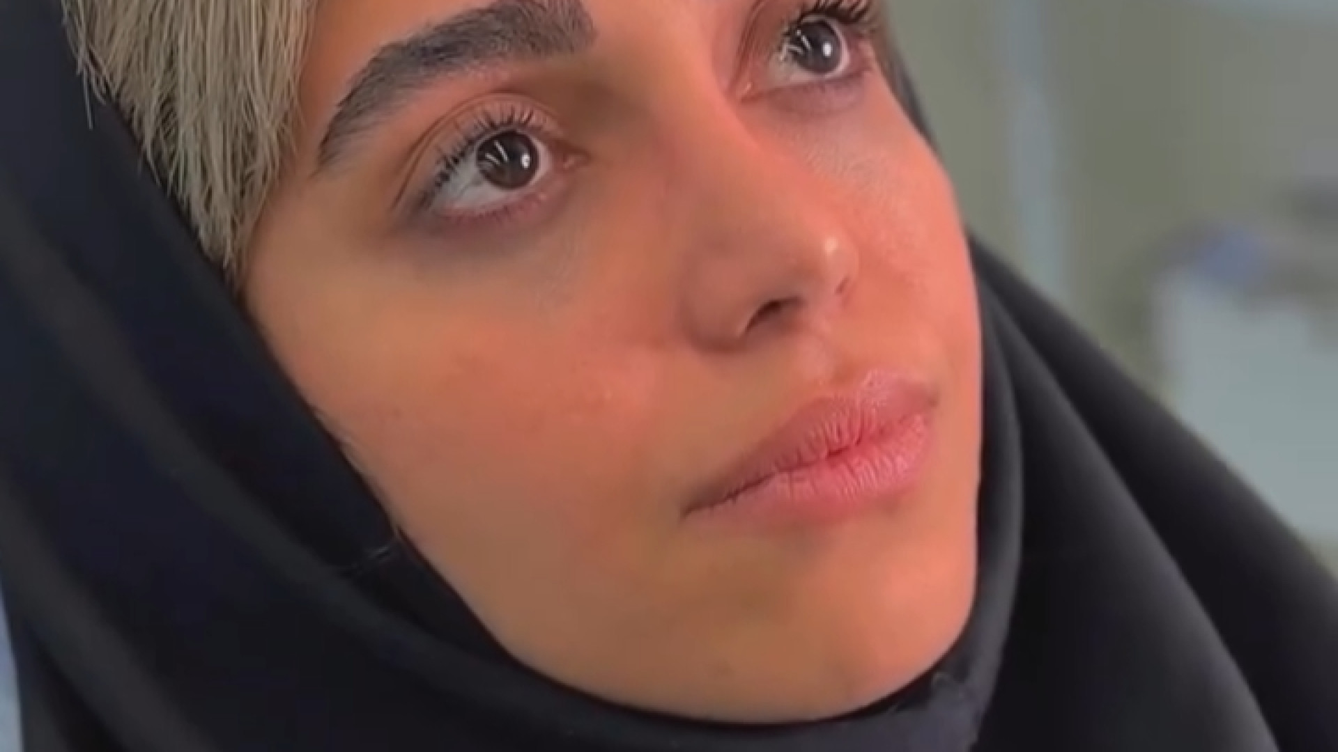 سه ماه بعد از جراحی بینی | دکتر محمد مجیدی دکتر محمد مجیدی - جراحی بینی به سبک طبیعی شیک