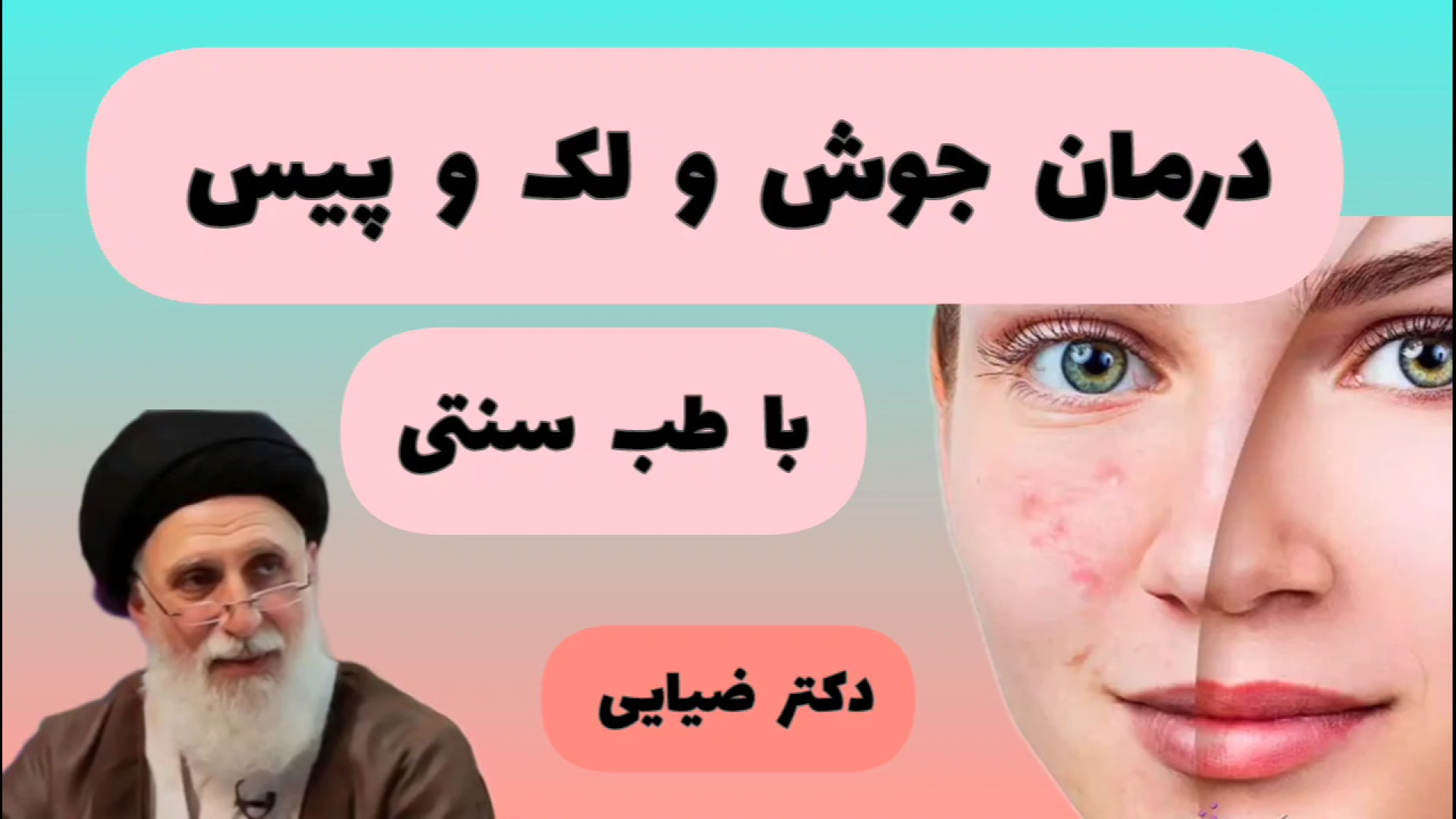 علت اصلی جوش صورت از دیدگاه دکتر ضیایی | درمان قطعی جوش با طب سنتی درمان سلولیت
