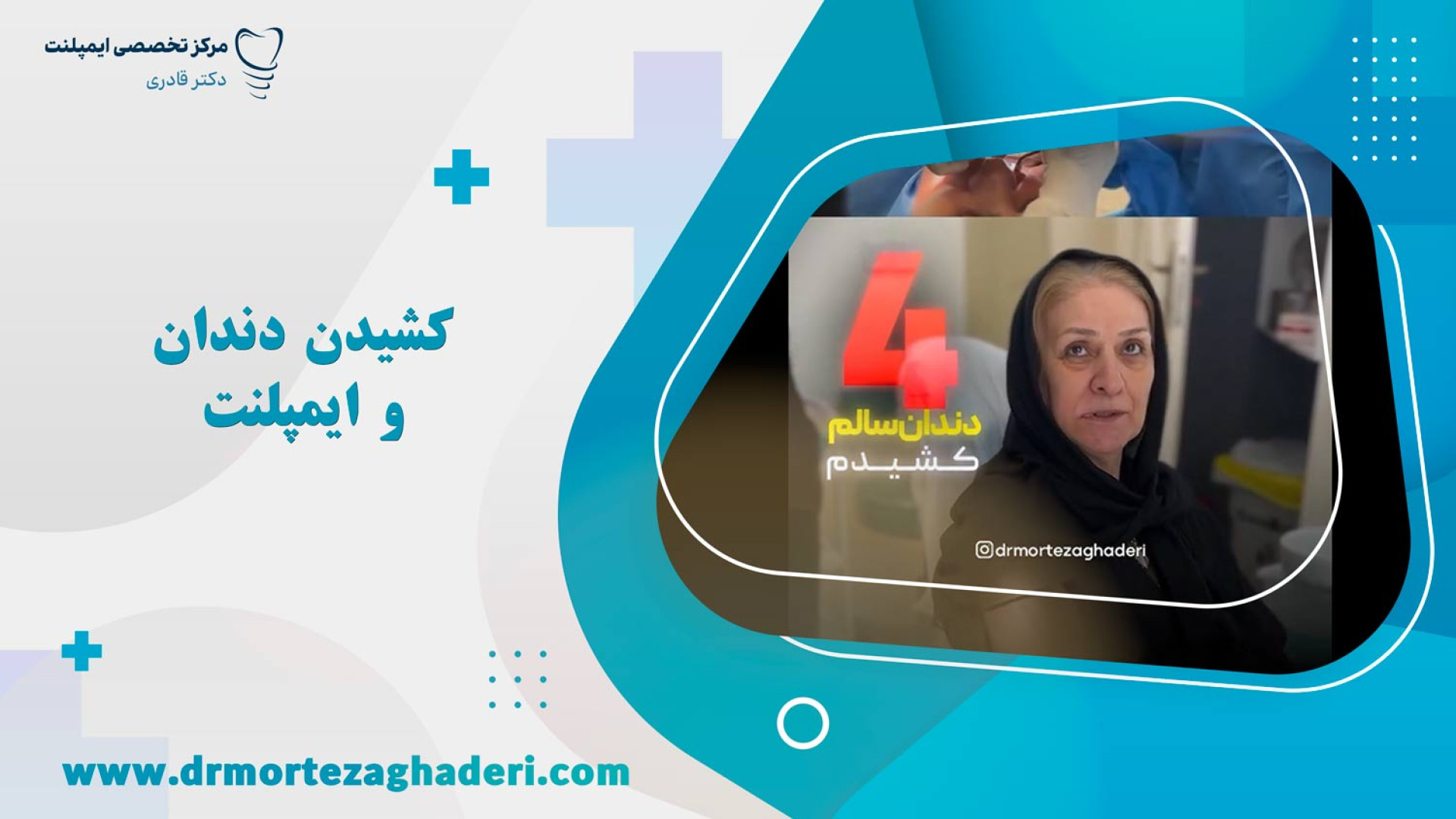 چرا دندان سالم رو کشید و ایمپلنت کرد؟ ایمونوانژیوگرافی