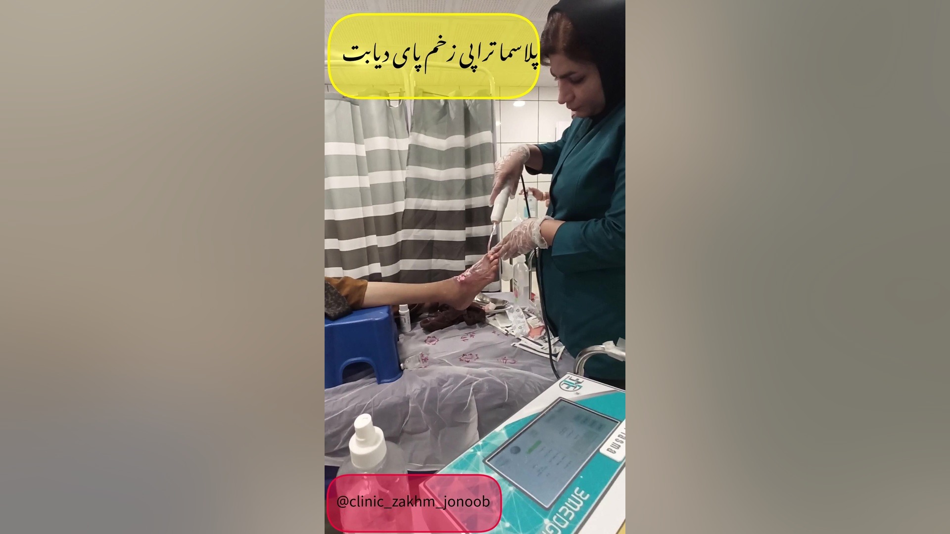 کلینیک زخم و سوختگی در لارو گراش (کامگار09178836839) عصب‌کشی