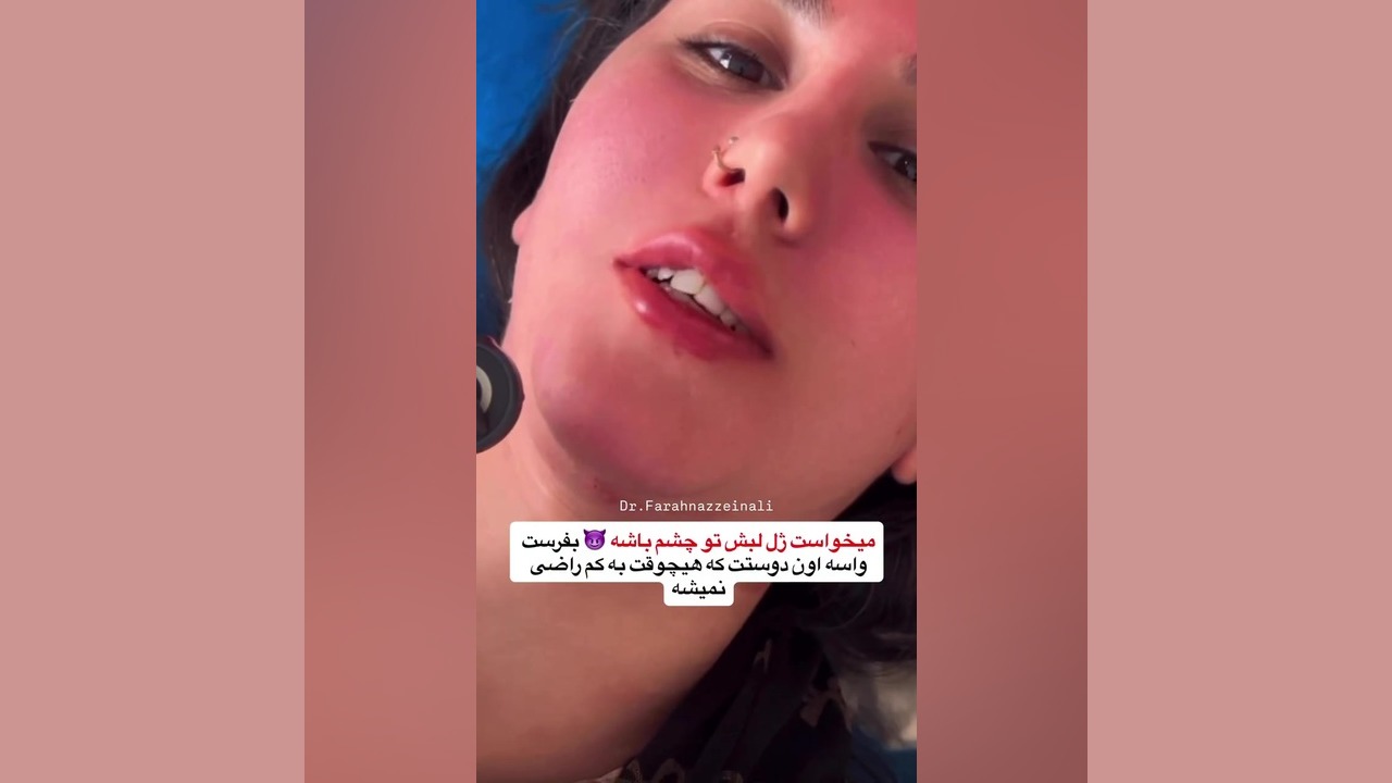 تو دوست داره همه متوجه فیلرایی که میزنی بشن یا نه؟ دکتر فرحناز زینعلی - متخصص پوست، مو، زیبایی زنجان