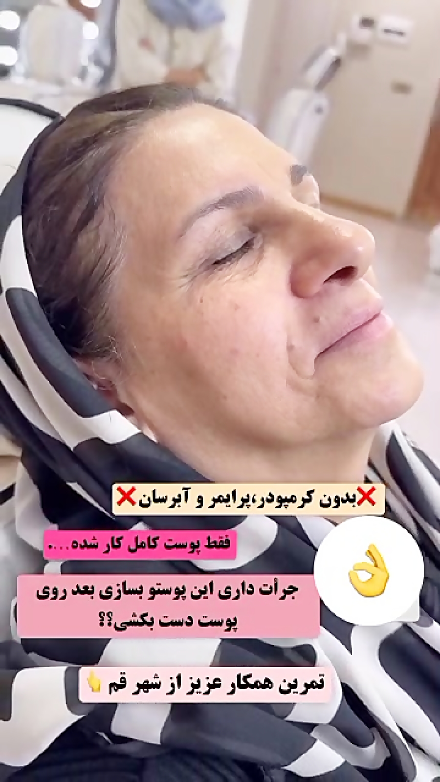 جدیدترین و ماندگارترین تکنیک پوست سازی ریچ