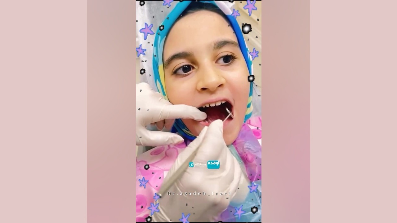 ترمیم پوسیدگی دندان لیزر کوانتومی جراحی چشم