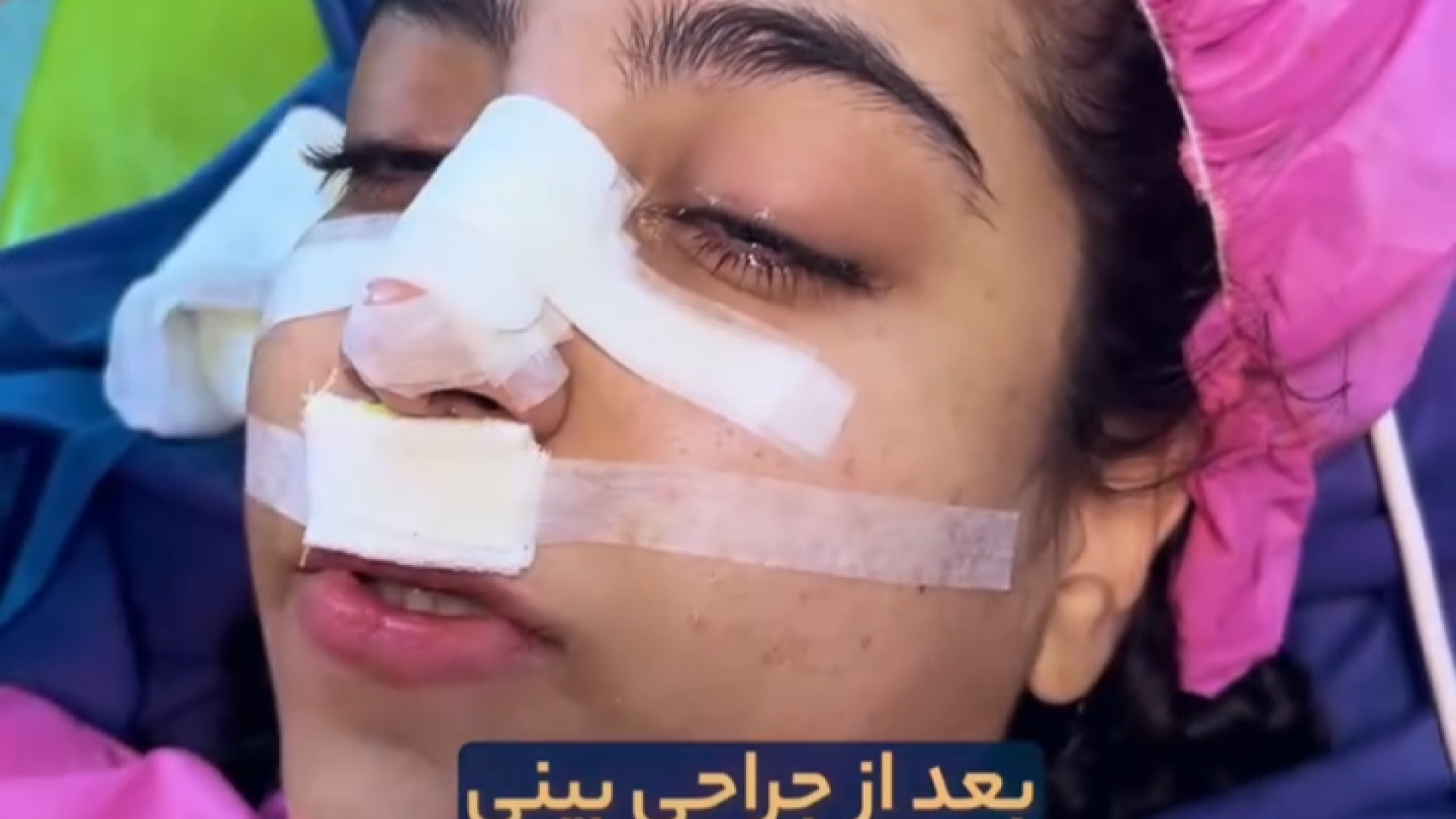 عمل بینی و ترس از بیهوشی | دکتر کیان احمدی مریل استریپ