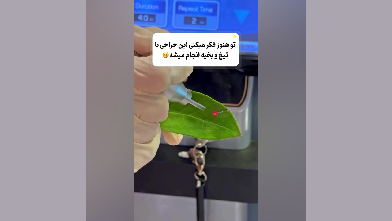 جدید ترین روش برش دکتر زهره امیری