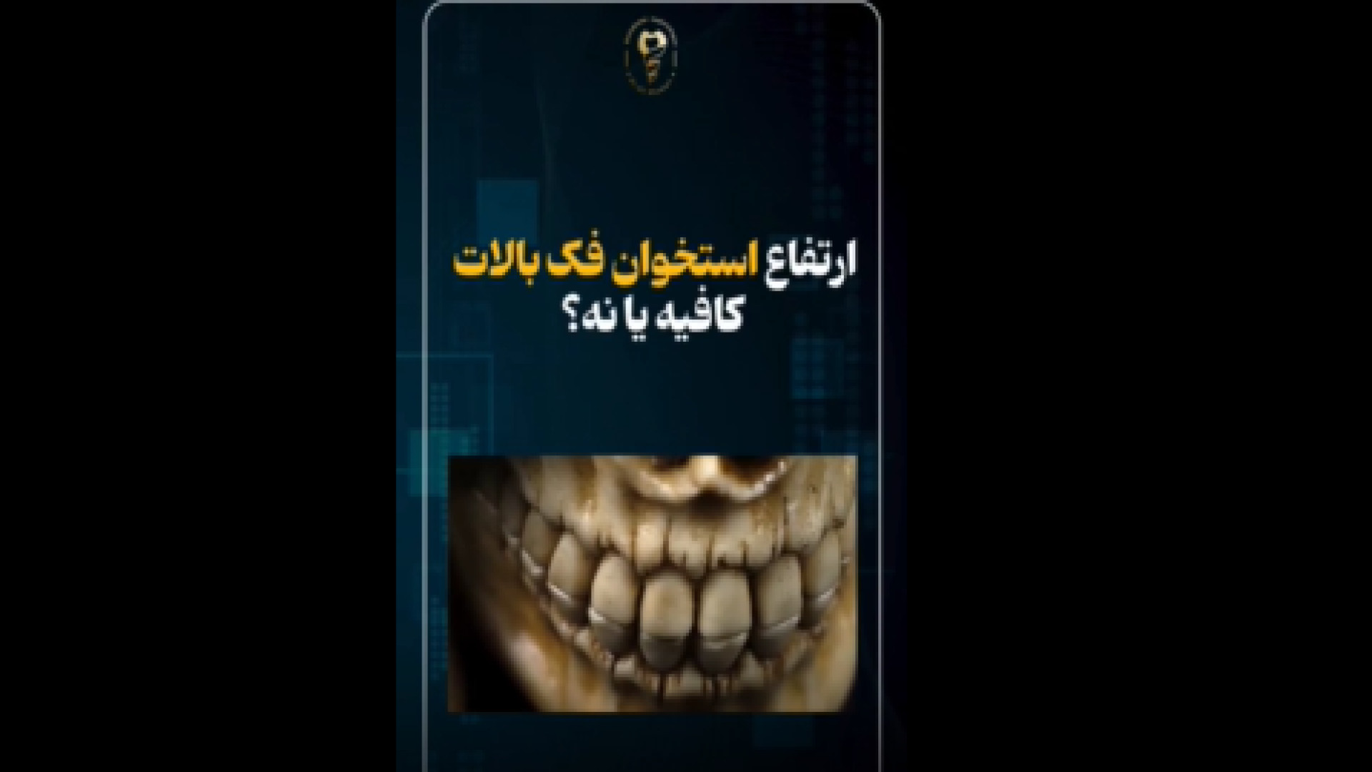 اهمیت ارتفاع استخوان فک بالا دکتر علی قمری - متخصص جراحی لثه و ایمپلنت