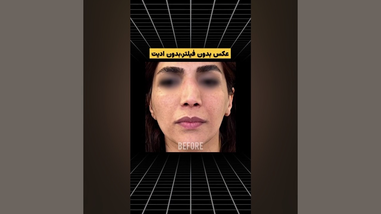 نمونه ویدیو از صورت زیباجوی عزیز خانم دکتر سوسن احمدی پیر شهید دکتر سوسن احمدی پیر شهید