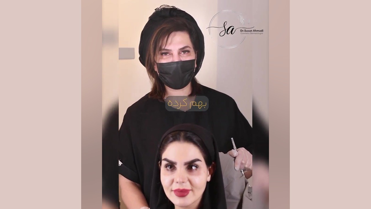 نمونه ویدیو زیباجوی عزیز با تغییر عالی تزریق زیر چشم دکتر سوسن احمدی پیر شهید