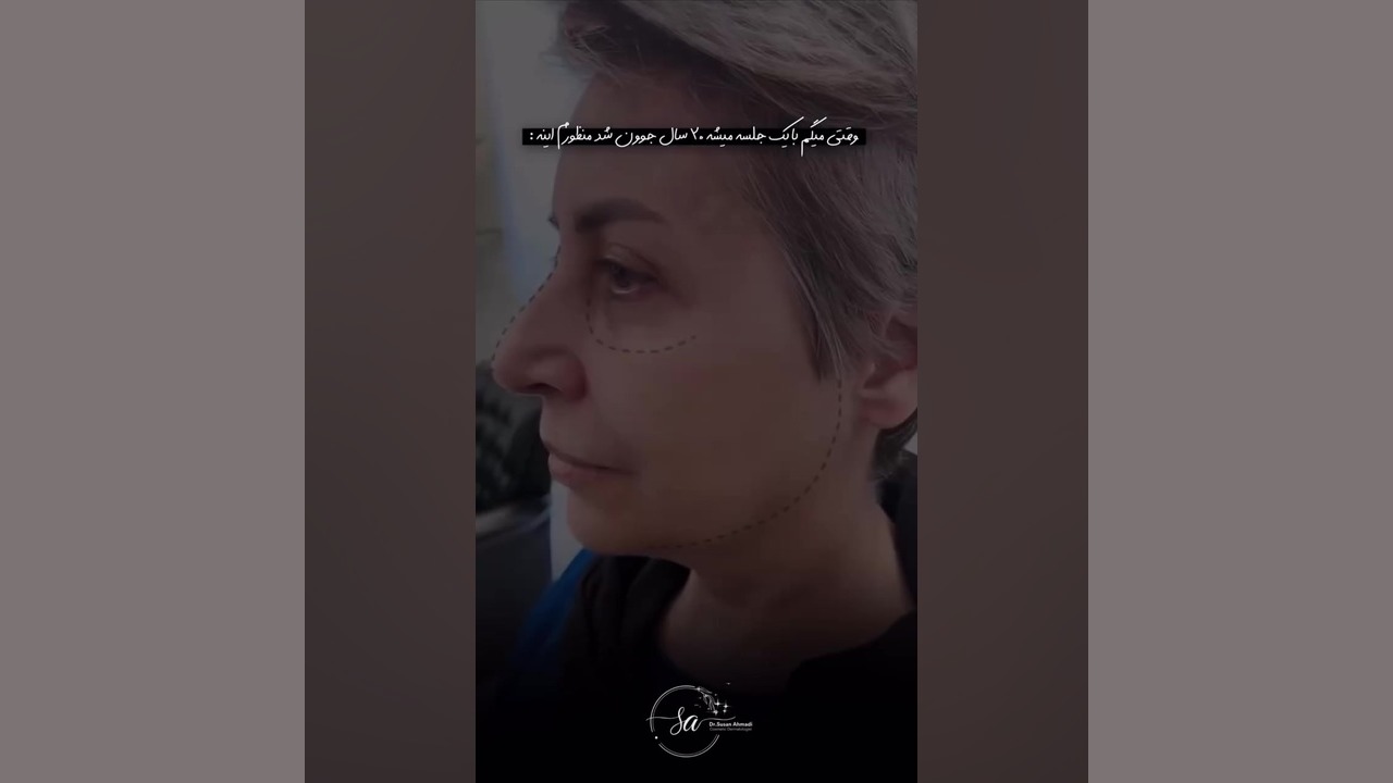 تغییری ماندگار در زیبایی شما | مشاوره دکتر سوسن احمدی دکتر سوسن احمدی پیر شهید