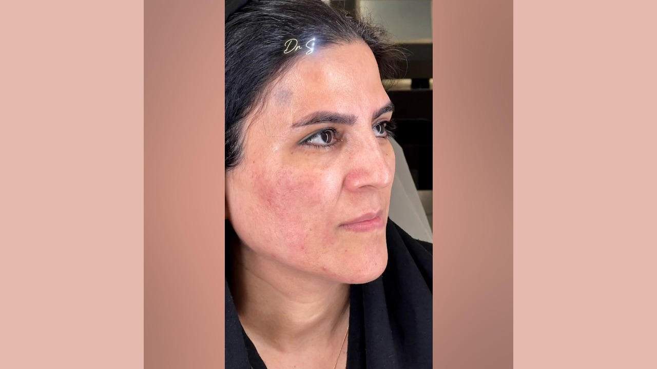 تصحیح فرم صورت: تناسب و زیبایی طبیعی | مشاوره دکتر سوسن احمدی دکتر سوسن احمدی پیر شهید