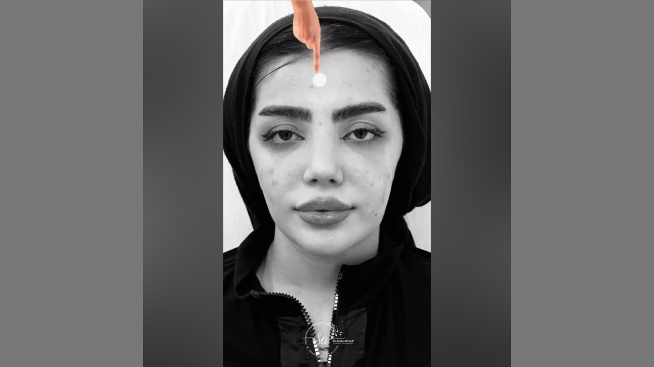 تغییر صد درصدی چهره با تکنیک های زیبایی | دکتر سوسن احمدی دکتر سوسن احمدی پیر شهید