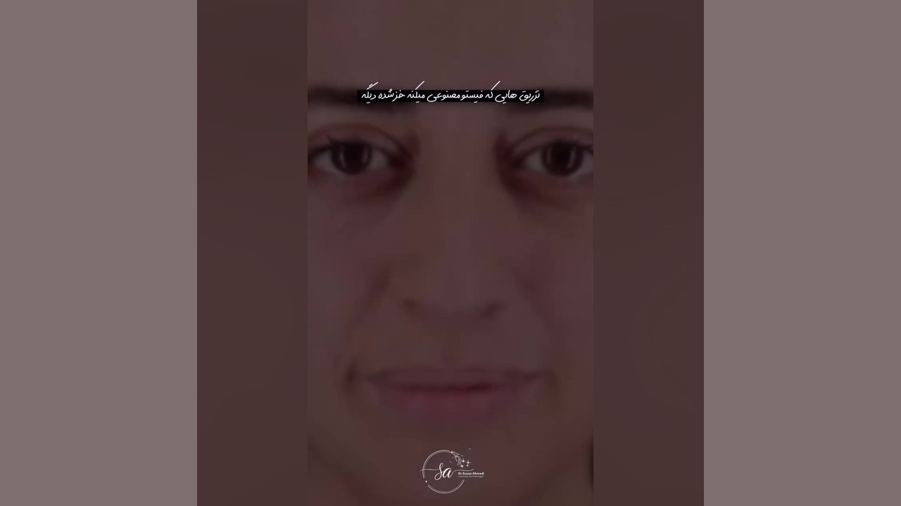 تغییر نچرال و زیبا با تزریق چربی طبیعی | دکتر سوسن احمدی دکتر سوسن احمدی پیر شهید