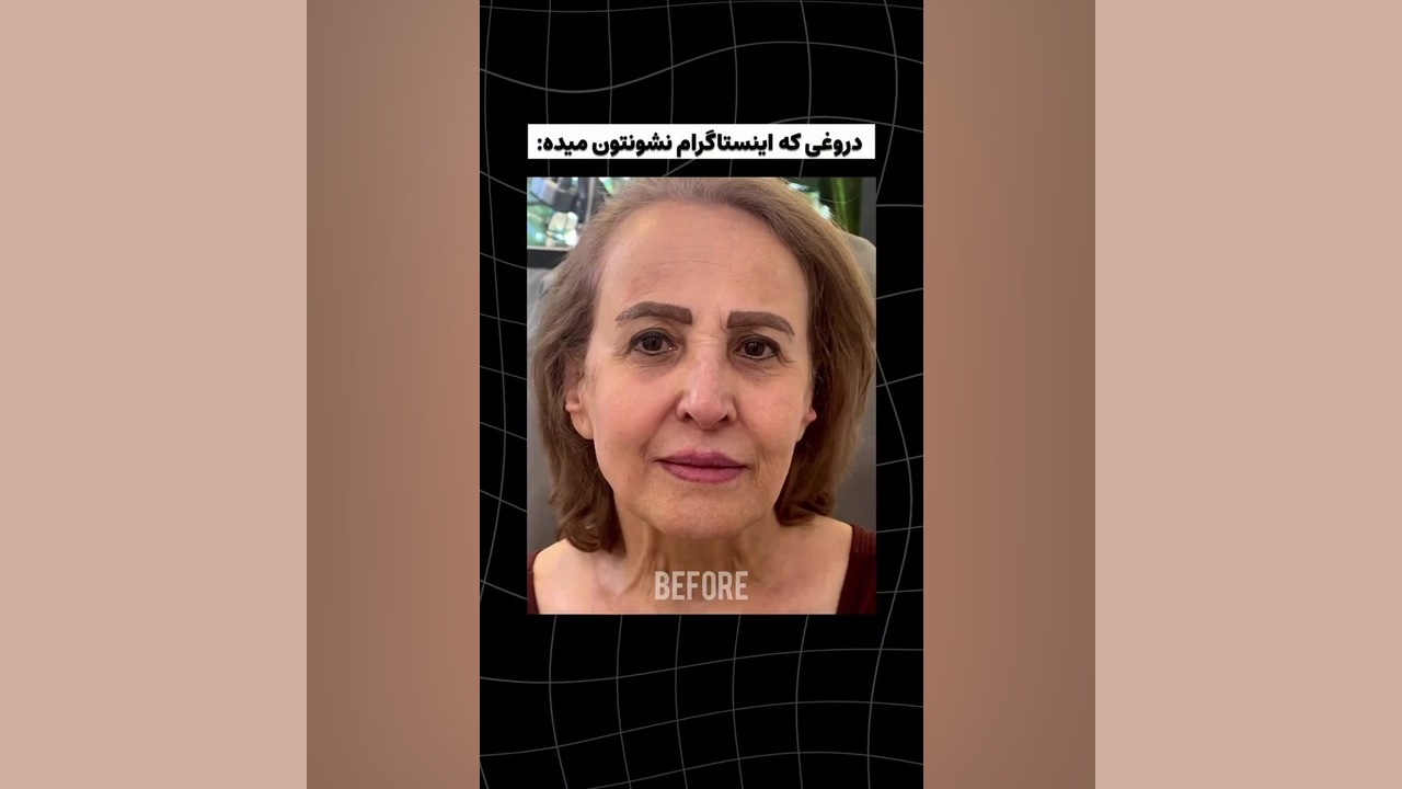 واقعیت زیبایی: دروغ هایی که اینستاگرام نشان می دهد | دکتر سوسن احمدی دکتر سوسن احمدی پیر شهید