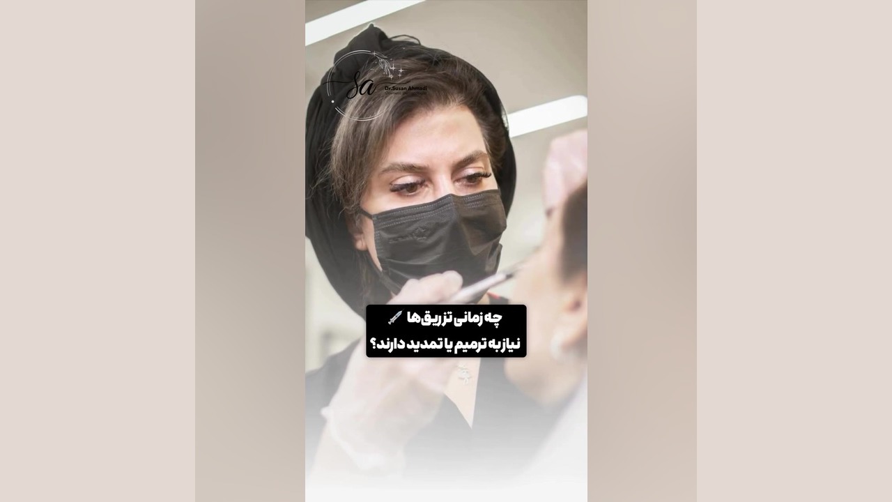 زمان مناسب تمدید تزریق چربی و فیلرهای زیبایی | دکتر سوسن احمدی دکتر سوسن احمدی پیر شهید