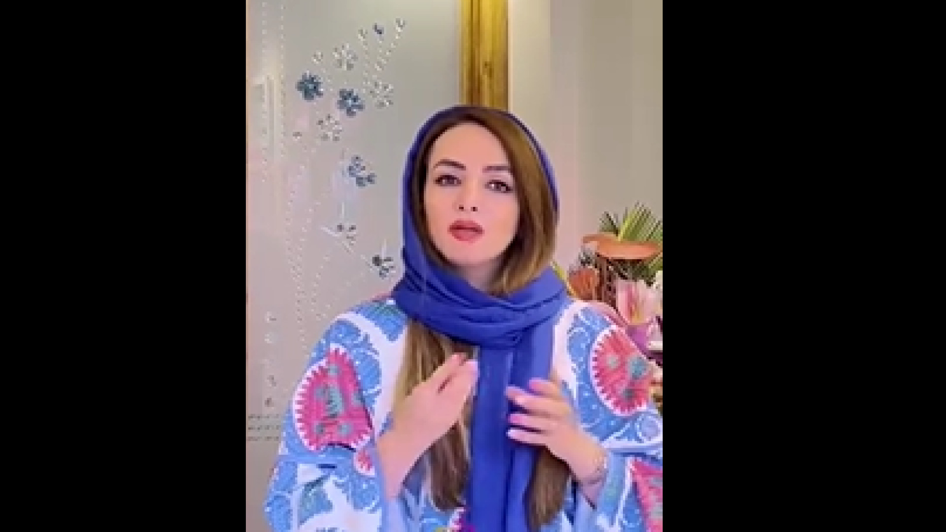 توضیحاتی درمورد پیوند استخوان دکتر ندا هادی-دندانپزشک زیبایی
