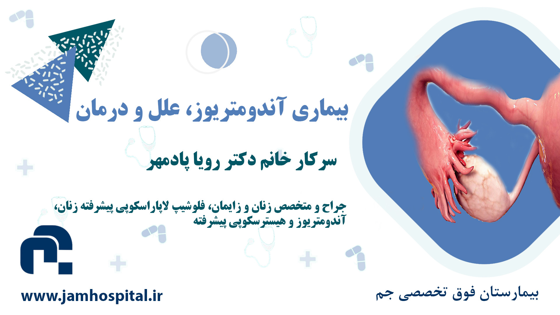 بيماري آندومتريوز، علل و درمان پسر آبجی