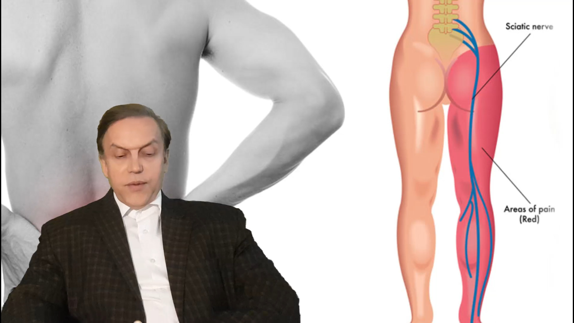 پرسش و پاسخ با استاد محمدرضا صفاری: علائم نشاندهنده بیماری سیاتالژی (درد سیاتیک) دیگو مارادونا