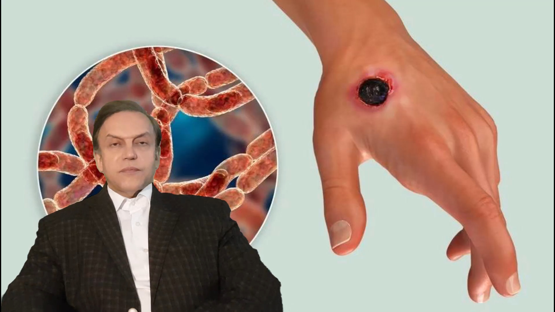 پرسش و پاسخ با استاد محمدرضا صفاری: علائم نشاندهنده بیماری سیاه زخم تست آنتی‌بادی مونوکلونال