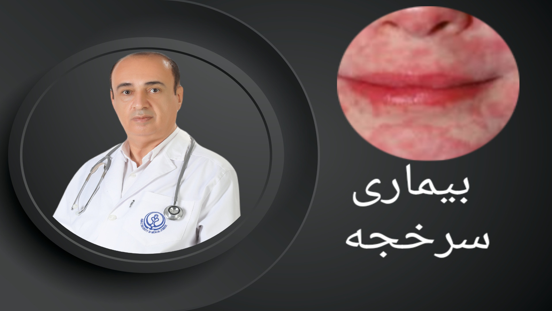 خطر بیماری ویروسی سرخجه برای مادران باردار عکس هنری