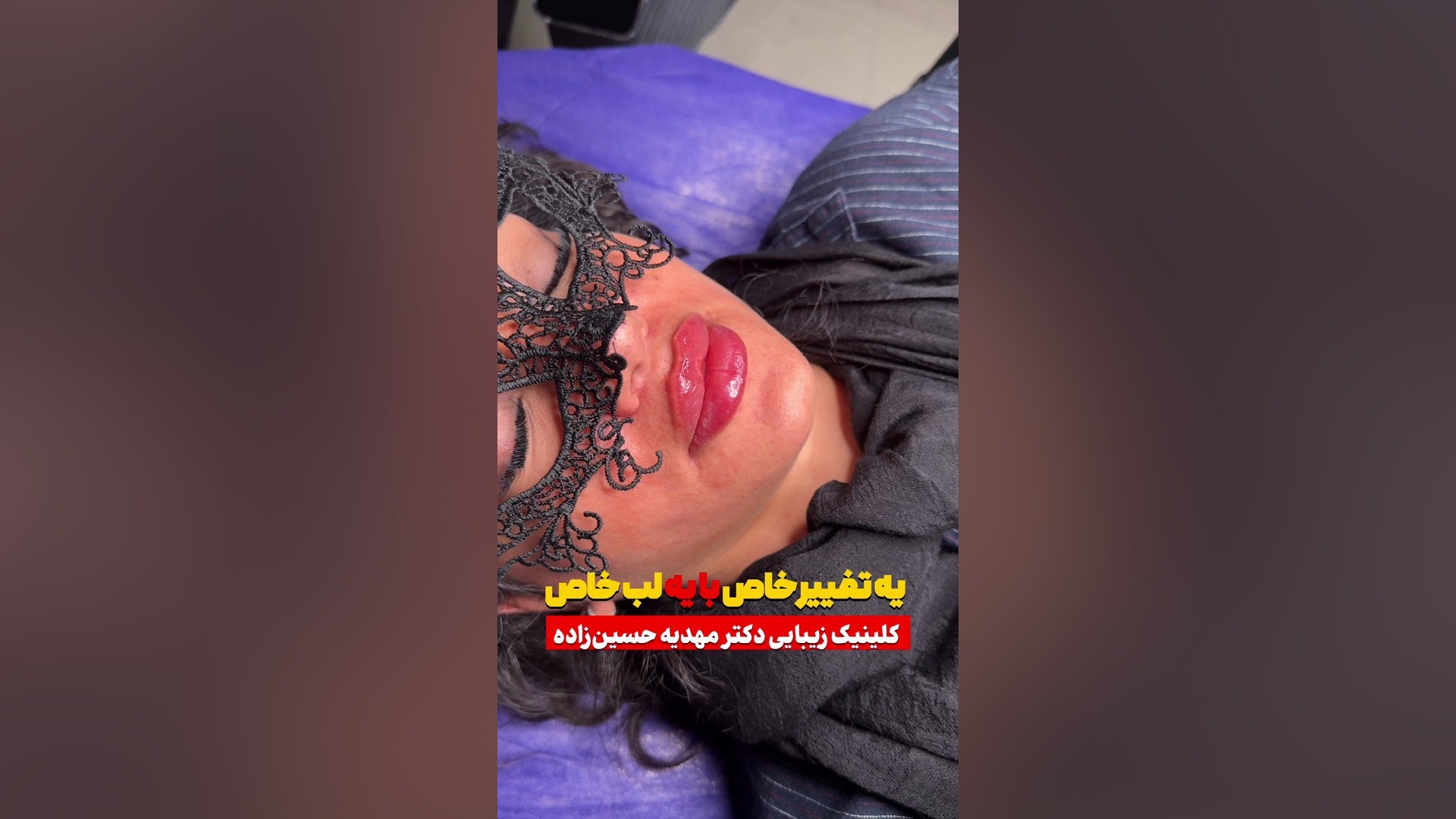 کلینیک زیبایی رشت دکتر مهدیه حسین زاده کلینیک زیبایی رشت دکتر مهدیه حسین زاده