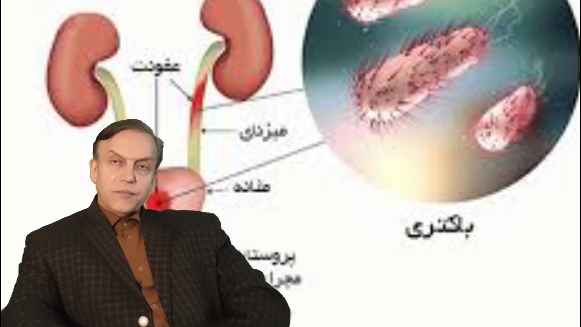 پرسش و پاسخ با استاد محمدرضا صفاری: علائم نشاندهنده بیماری عفونت دستگاه ادراری استفان کری