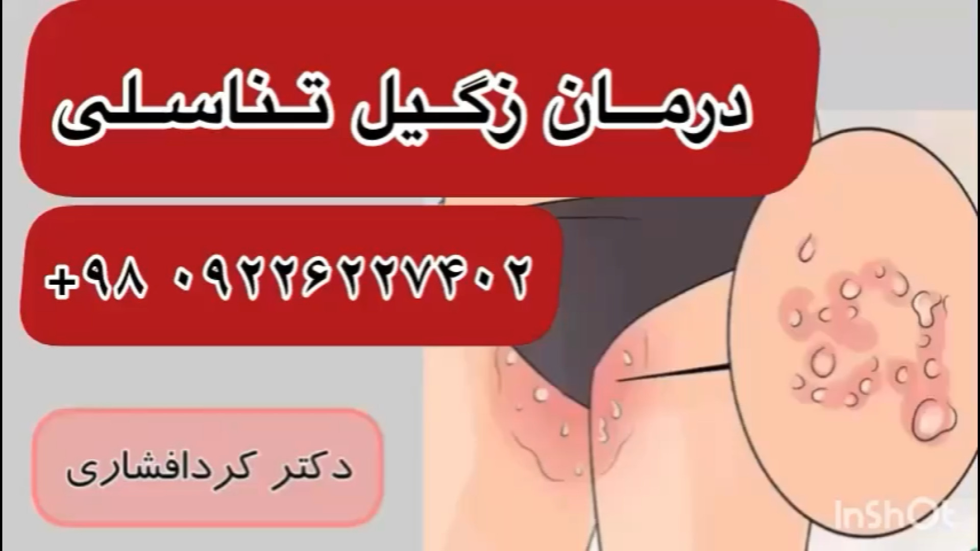راهکارهای درمان HPV با طب سنتی | توصیه‌های دکتر کردافشاری جراحی گوش