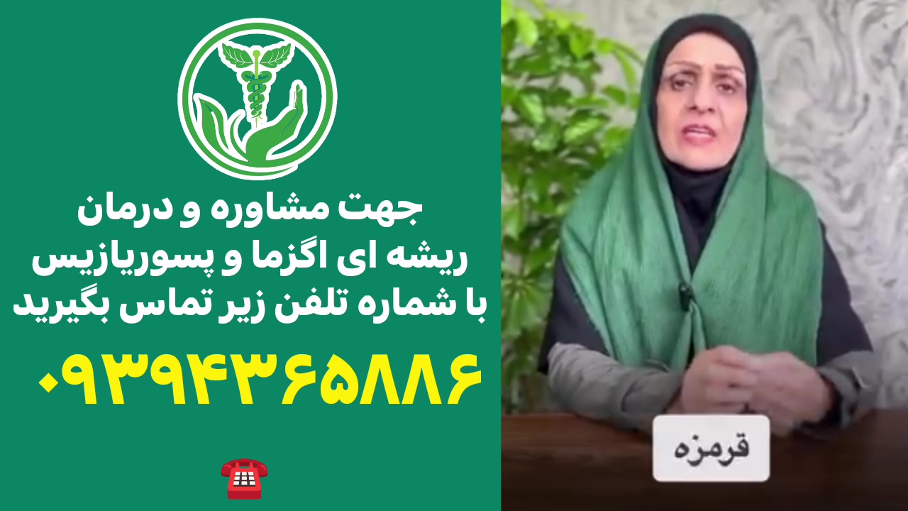 درمان اگزما و پسوریازیس/09394365886 کلینیک زیبایی