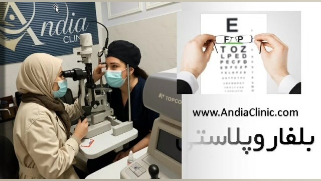 تاثیر بلفاروپلاستی روی بینایی دکتر پوست