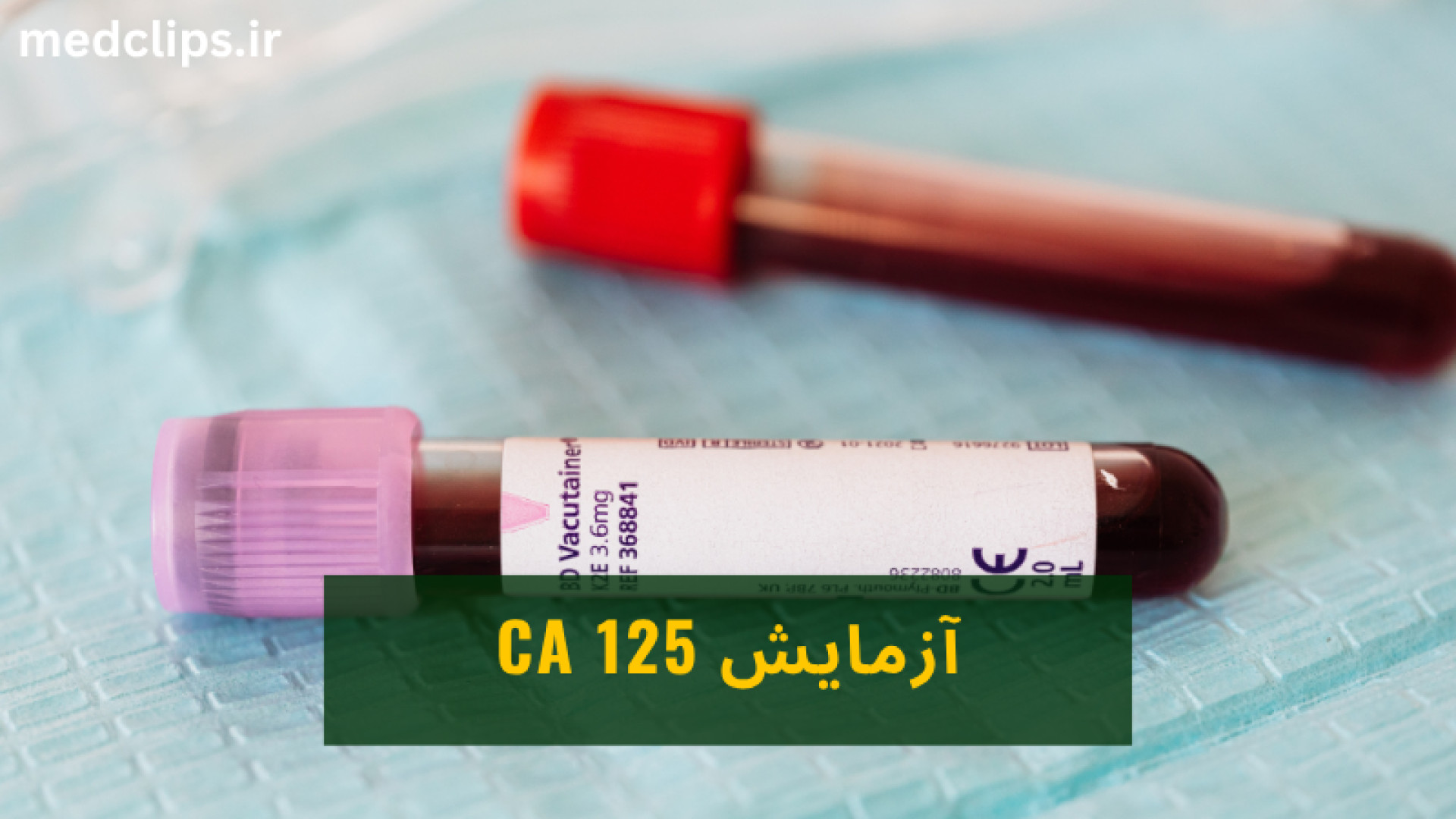 آزمایش سی‌اِی ۱۲۵؛ کلید تشخیص بهتر وضعیت تخمدان‌ها! ترمیم سوختگی