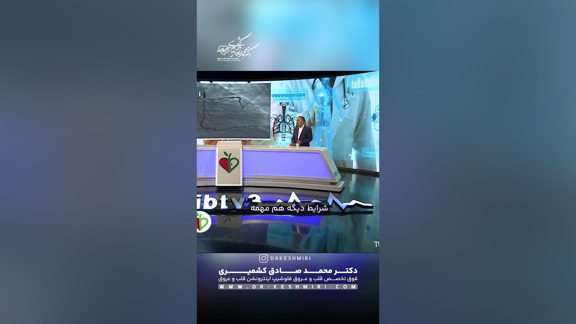 سه نشانه منع عمل قلب باز جنیفر لارنس