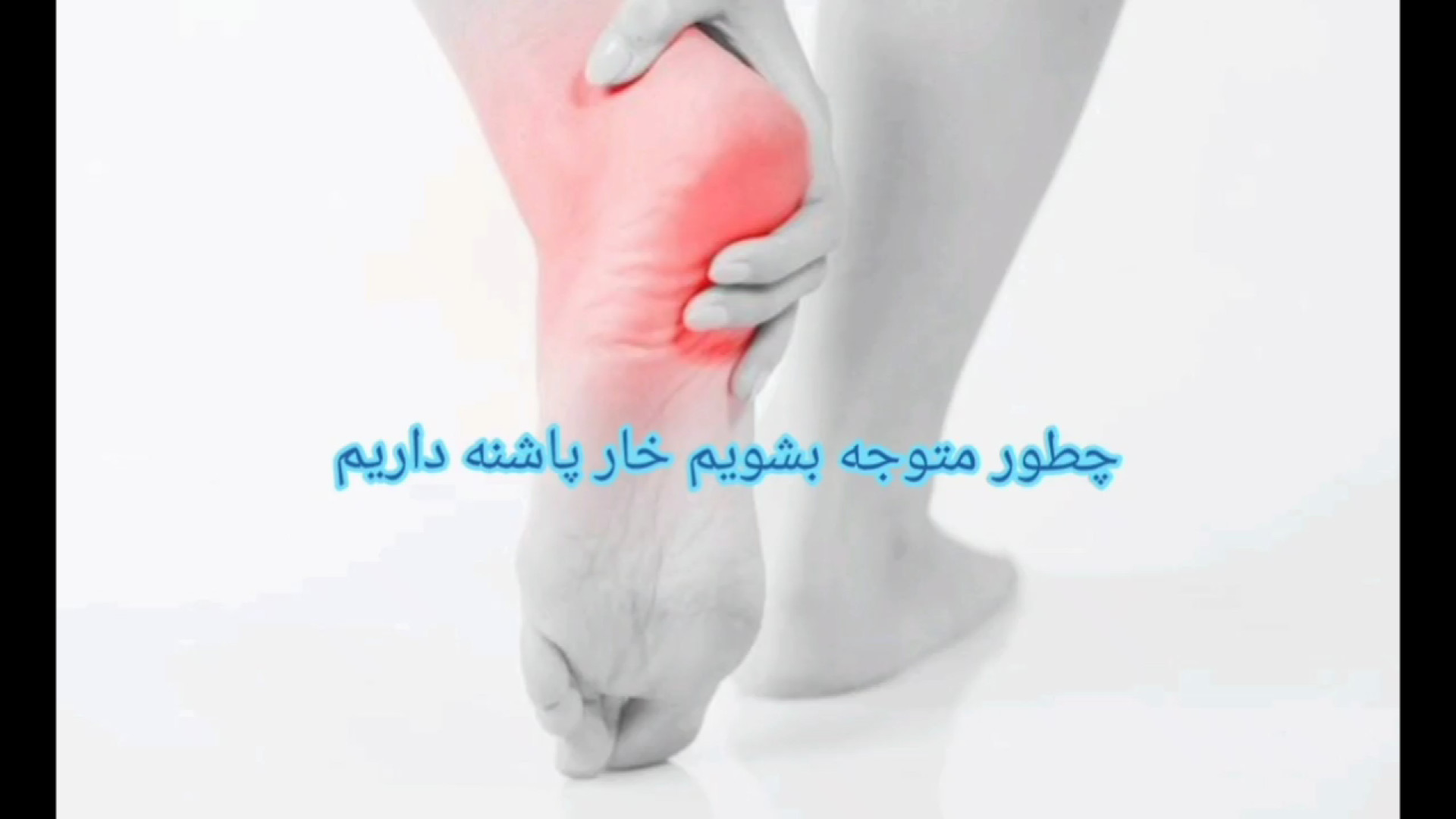 تشخیص خار پاشنه (چطور بفهمیم خار پاشنه داریم) دندانپزشک زیبایی