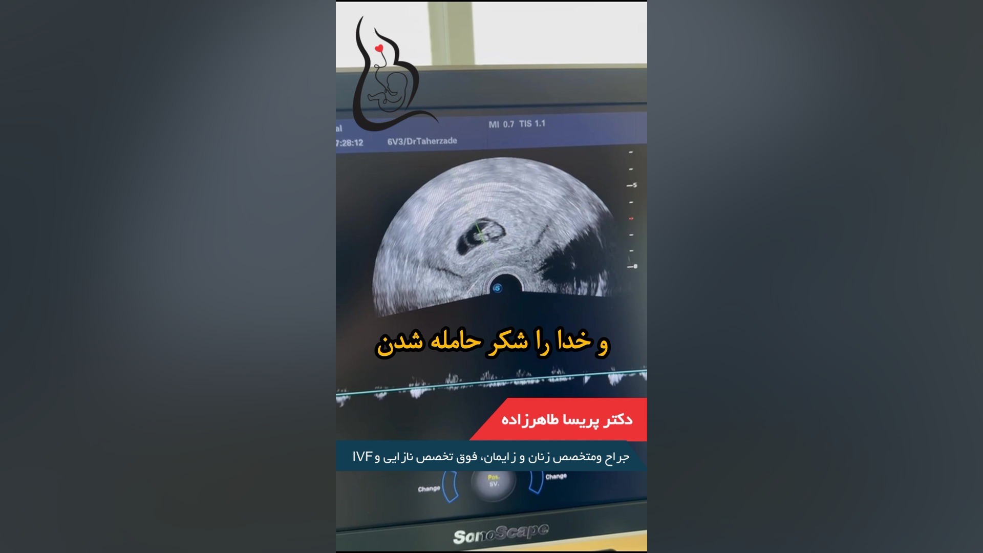 سونوگرافی بارداری هفته دهم گربه فضایی