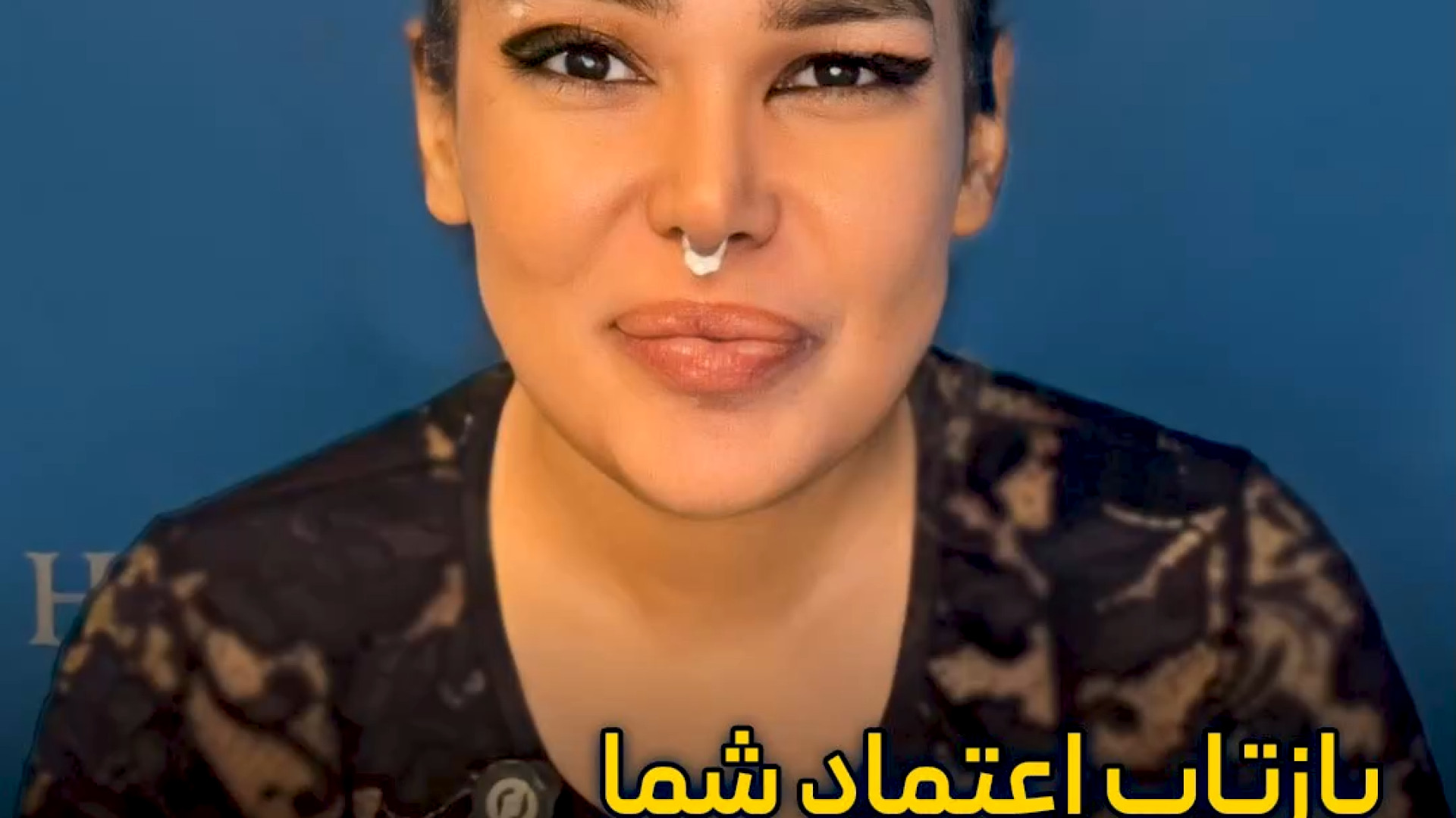 لیفت آندوسکوپی پیشانی، گِرفت لب، پروتز سینه و بوکال فت | دکتر عطاالله حیدری عمه پری