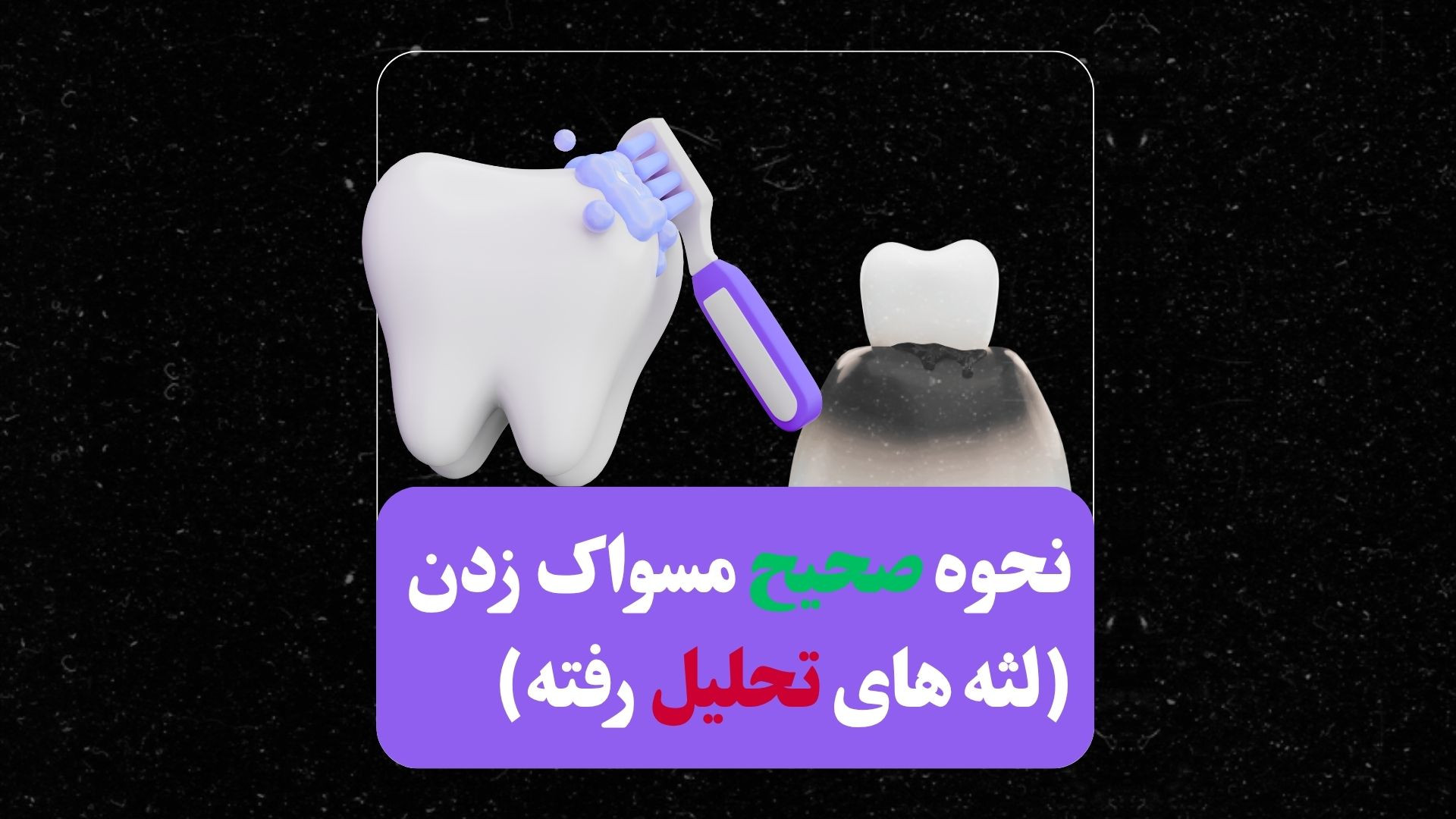 نحوه مسواک زدن لثه ی تحلیل رفته لمینت
