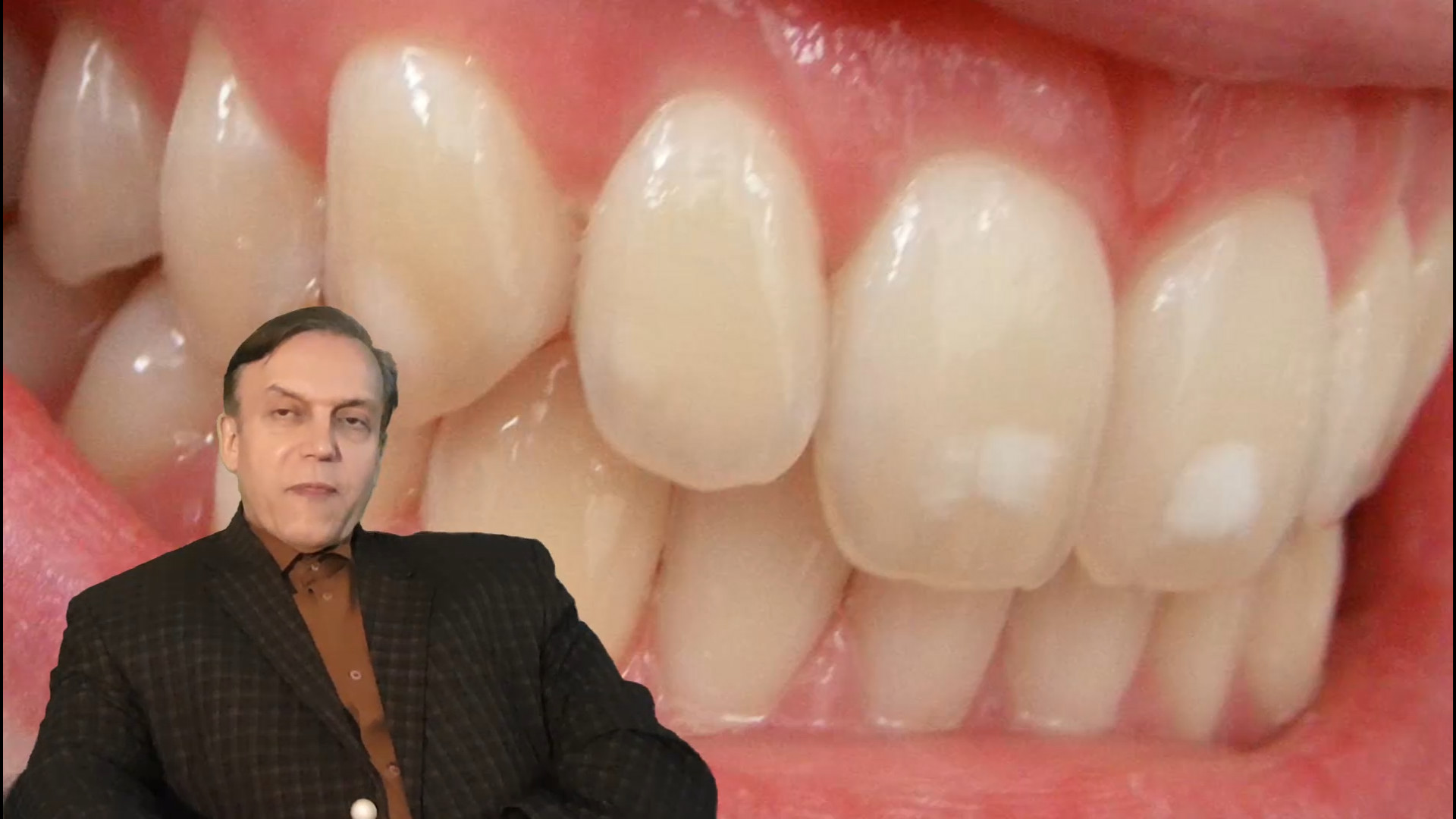 پرسش و پاسخ با استاد محمدرضا صفاری: علائم نشاندهنده بیماری فلوئورزیس دندانی مایکل جردن