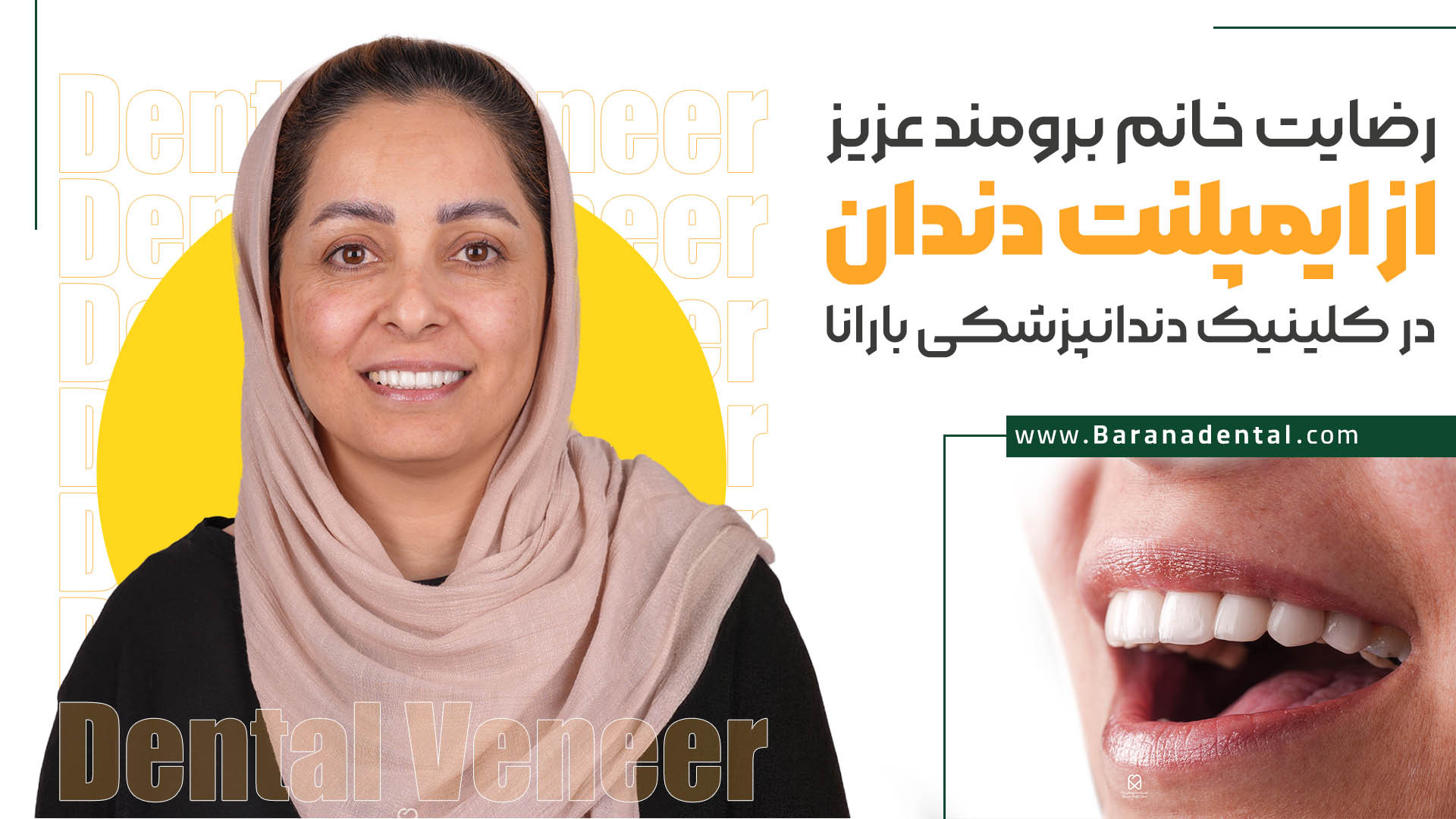رضایت خانم برومند از ایمپلنت دندان در کلینیک بارانا دستگاه فیبر نوری جراحی
