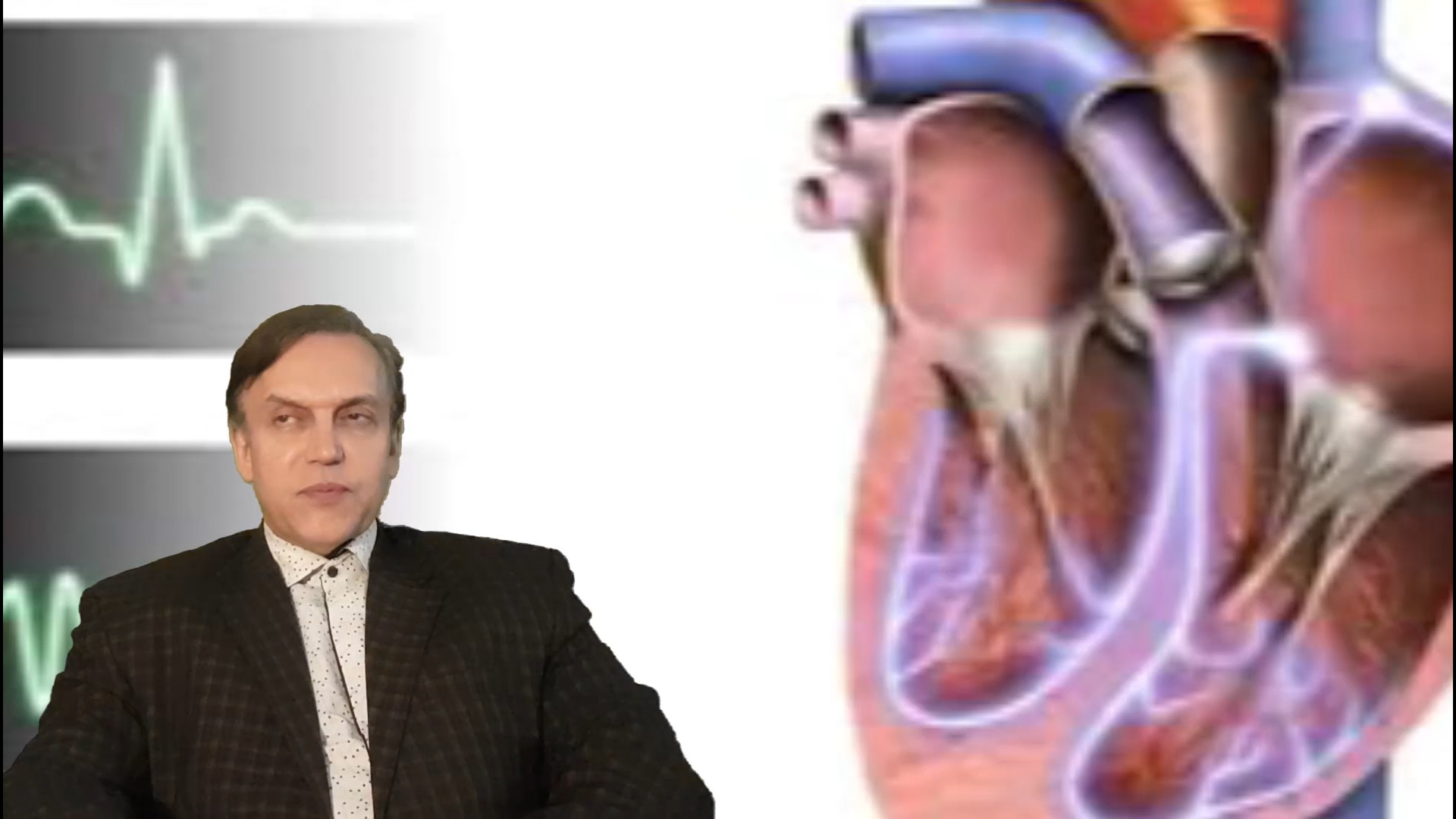 پرسش و پاسخ با استاد محمدرضا صفاری: علائم نشاندهنده بیماری فیبریلاسیون بطنی ابرسانی پوست