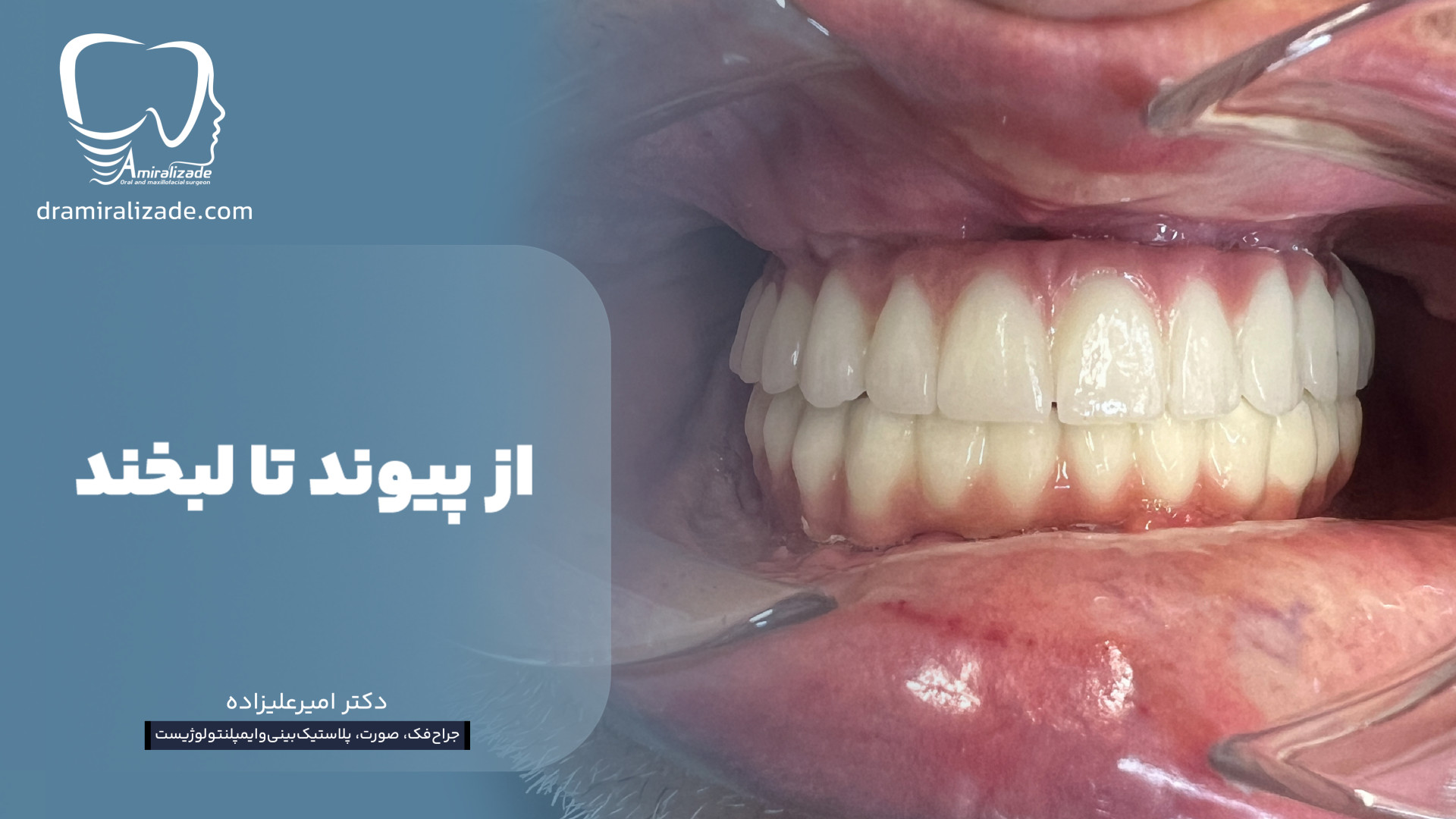 نتیجه صبر همیشه حیرت انگیزه… کیهان کلهر