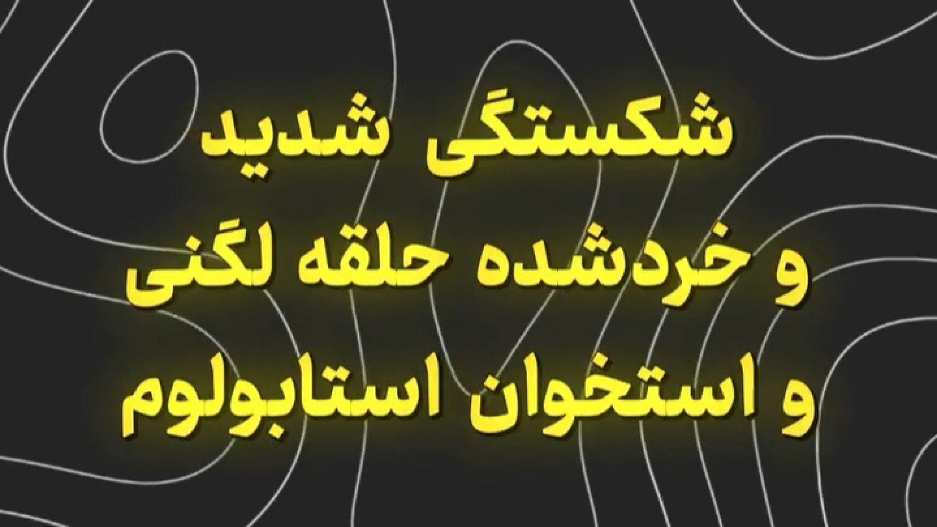 شکستگی شدید حلقه لگنی داریوش