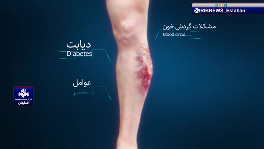 تجهیز بیمارستان فارابی اصفهان به دستگاه های پلاسمای سرد توپوتیکان