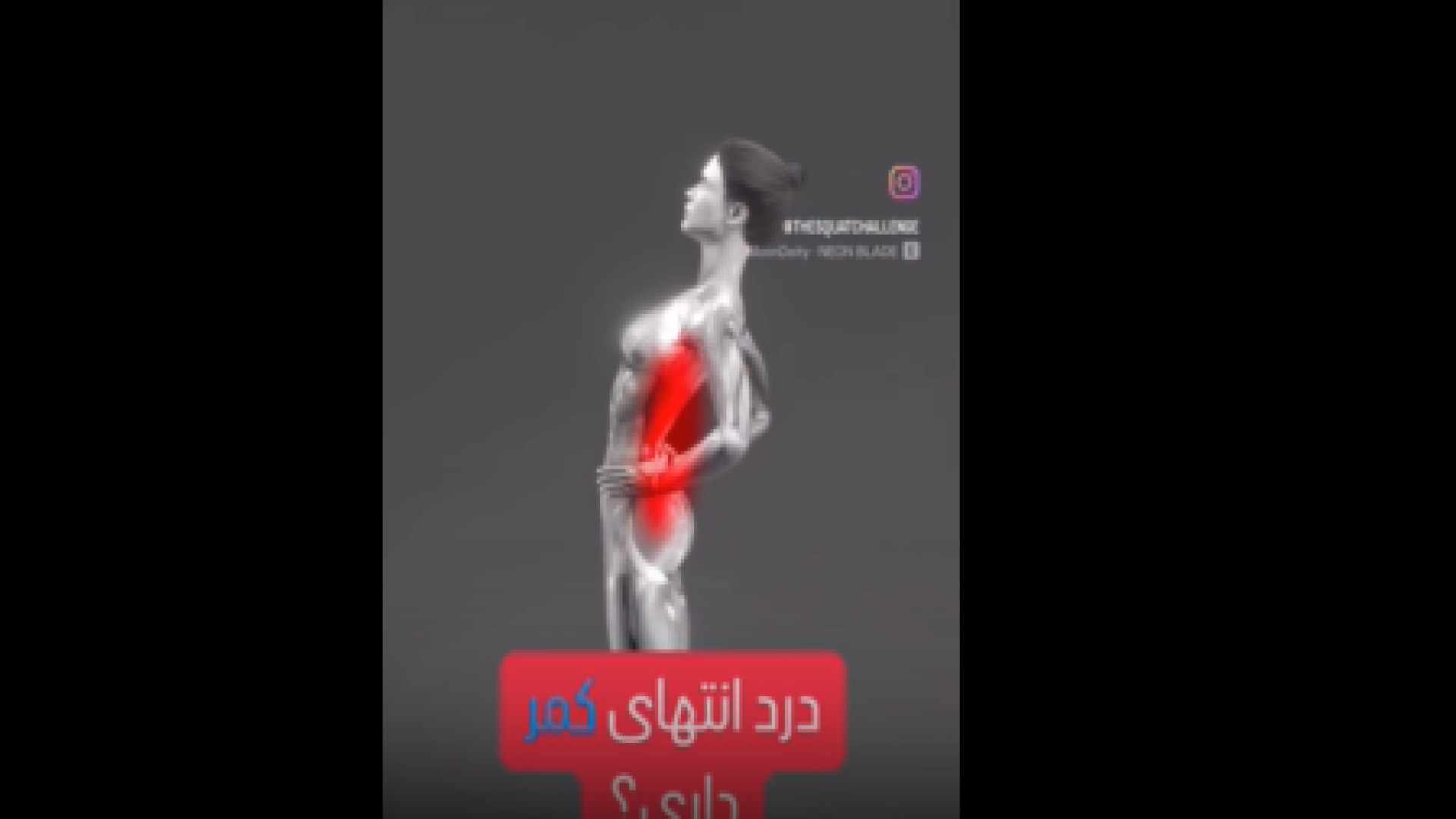 درمان درد انتهای کمر عصب‌کشی