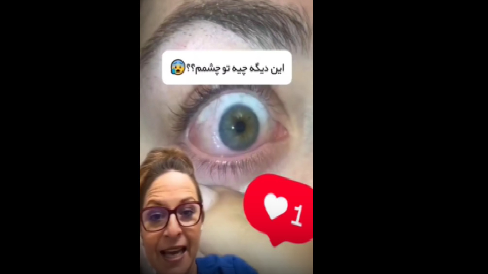 علائم الرژی چشمی دکتر شهرام سیدی متخصص آلرژی و ایمونولوژی
