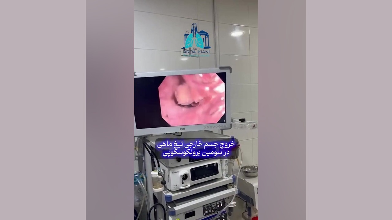 خروج جسم خارجی تیغ ماهی دکتر اردا کیانی