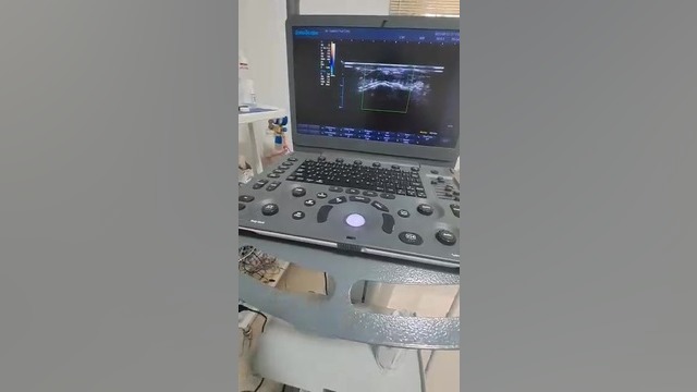 گزگز دست دکتر محدثه آزادواری